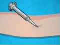 Juego  Operate Now: Eardrum Surgery